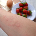 The Truth About Anaphylaxis and Food Allergies